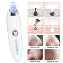 Removedor de Cravos - Limpeza de Pele Facial